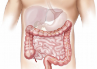 Colon irritabile
