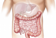 Colon Irritabile